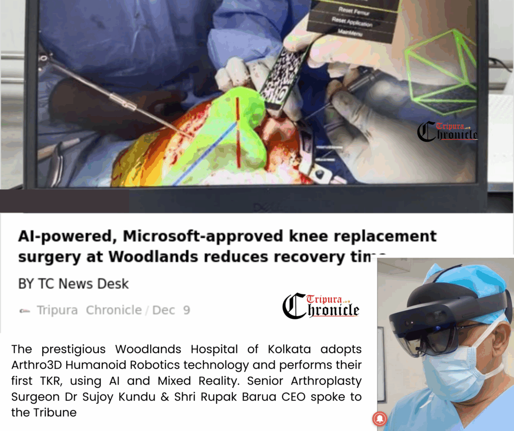 AI in the knee replacement